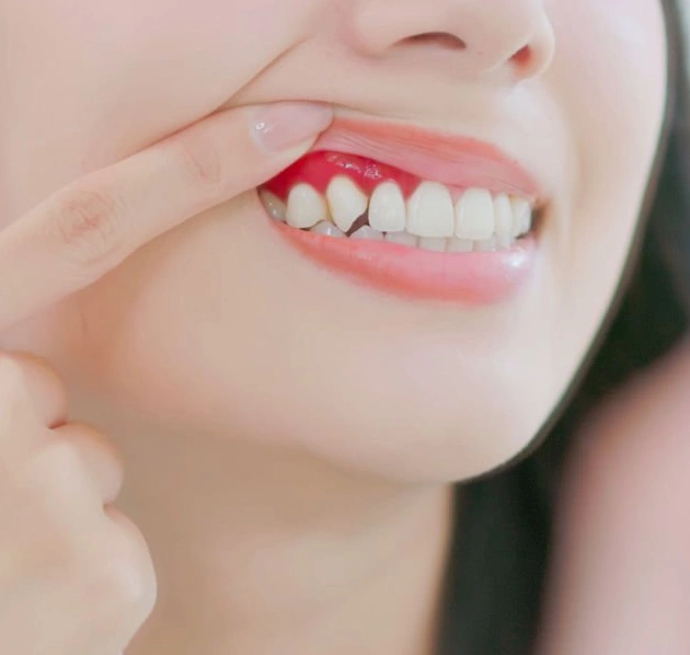 Close-up of person's smile showing healthy white teeth and gums.