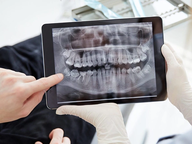 Dentist reviewing dental X-ray on tablet in clinical office setting.