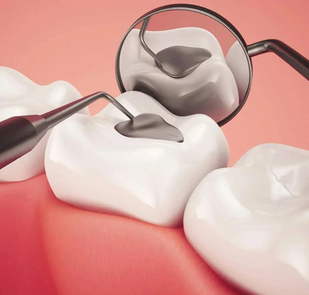 Dental mirror examining white tooth model on pink gum surface during oral examination.