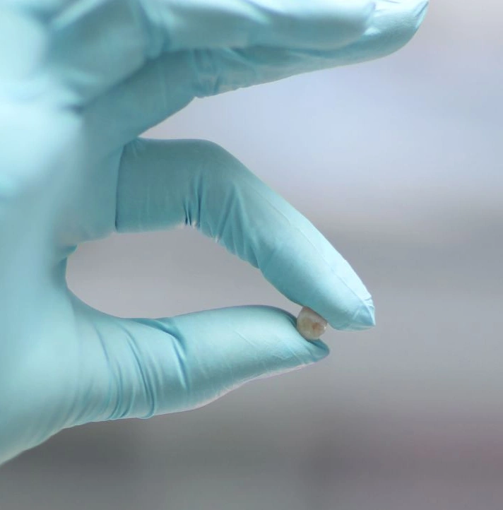 Gloved hand holding dental implant against blurred clinical background.