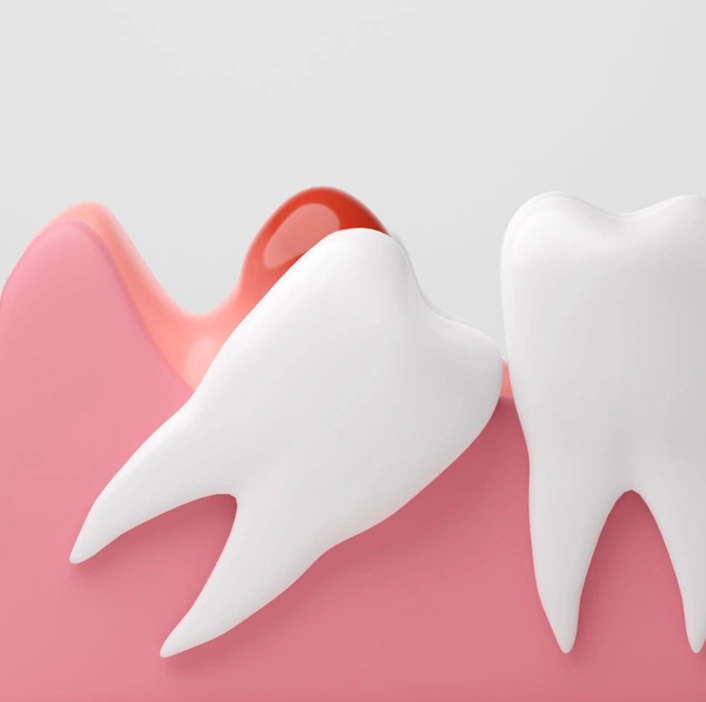White tooth model on pink background representing dental care and oral health services.