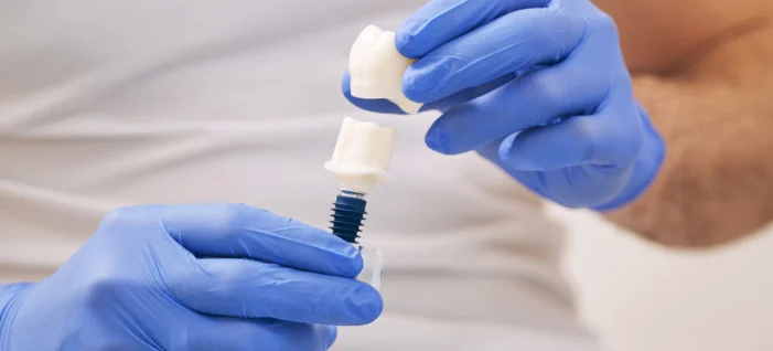Gloved dental professional holding dental implant component during procedure or consultation.